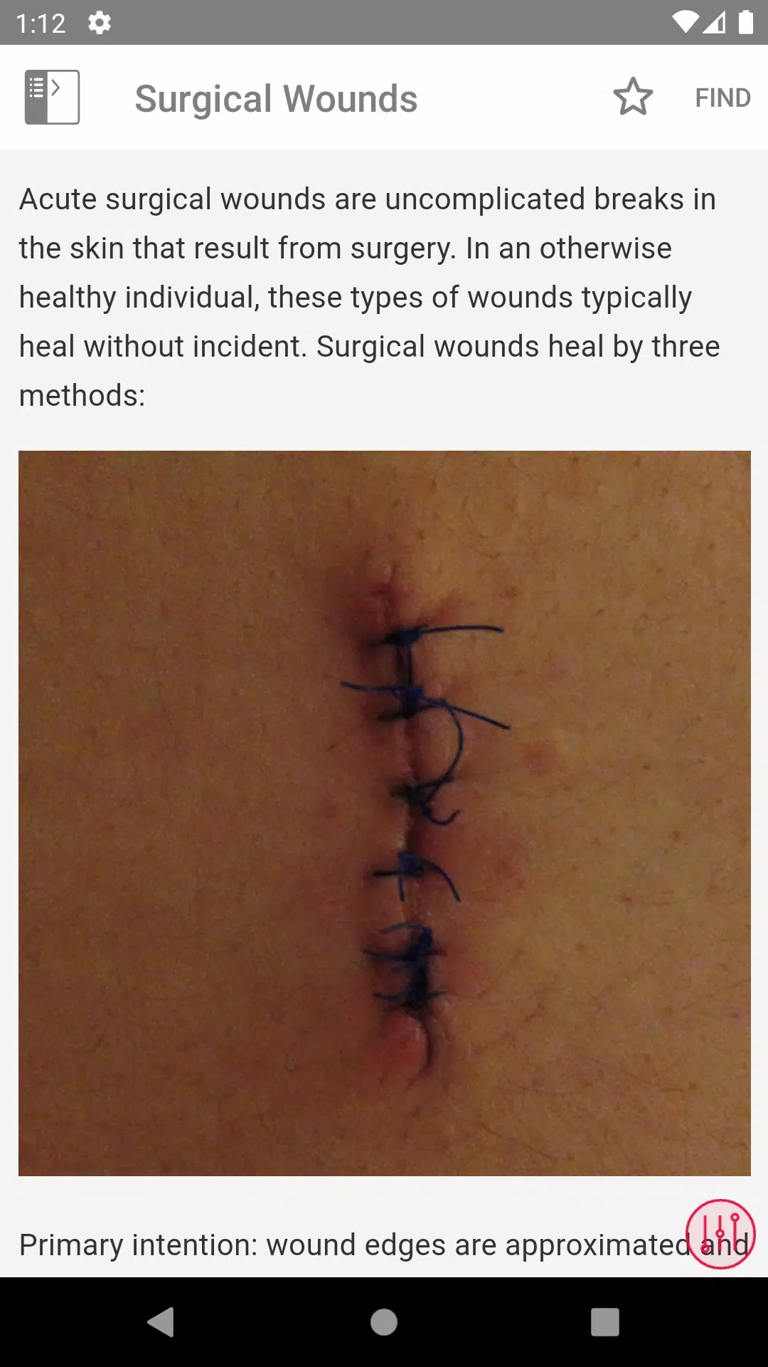 Schermata Wound Care MI Visual 4