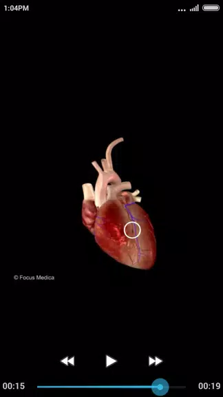Cardiology-Animated Dictionary应用截图第3张