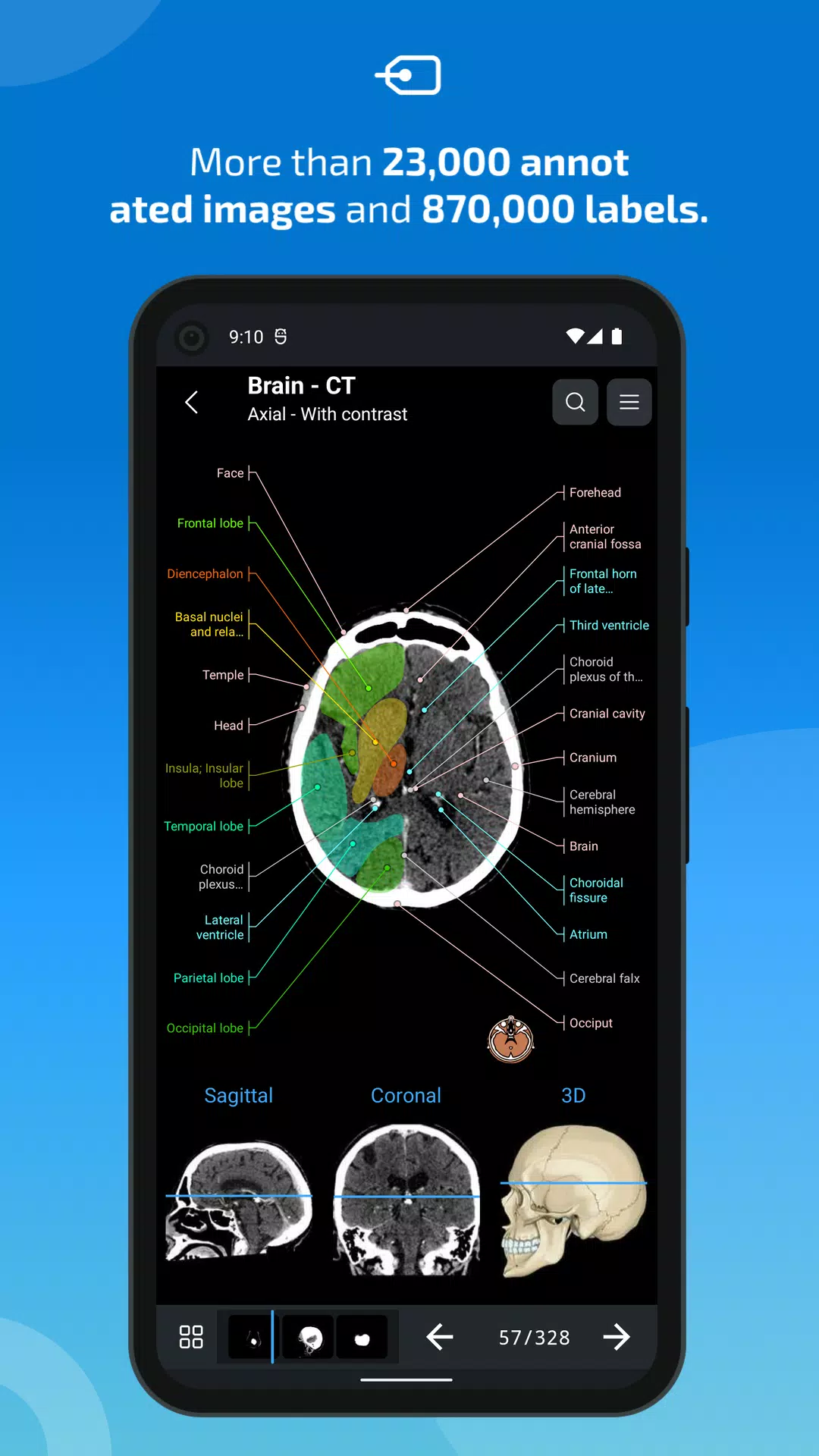 e-Anatomy ဖန်သားပြင်ဓာတ်ပုံ 2