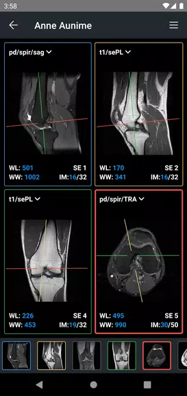 IDV - IMAIOS DICOM Viewer Ekran Görüntüsü 3