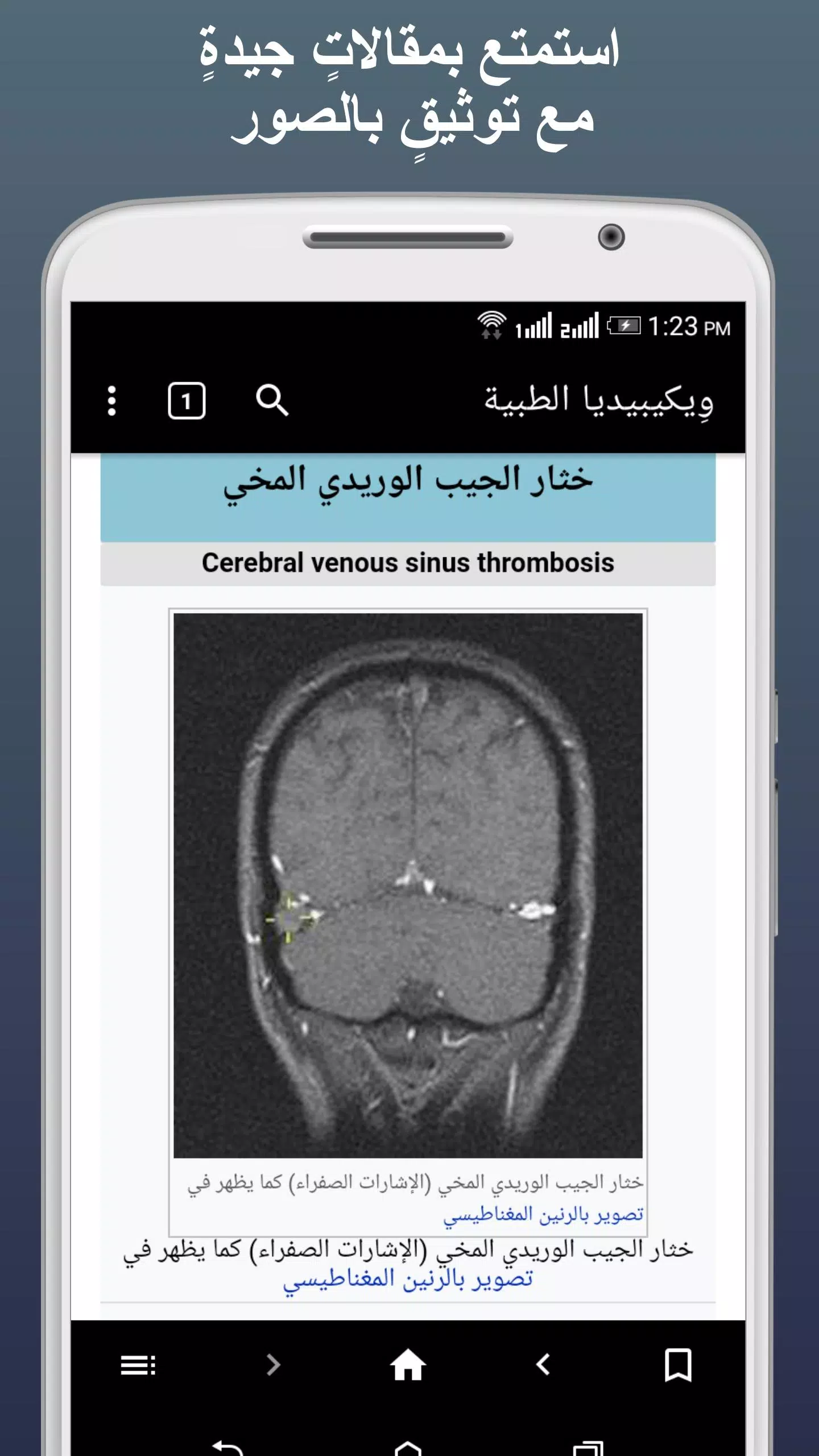 Schermata ويكيبيديا الطبية 3
