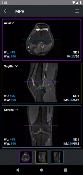 IDV - IMAIOS DICOM Viewer ဖန်သားပြင်ဓာတ်ပုံ 4