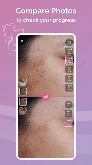 FeelinMySkin: Skincare Routine应用截图第3张