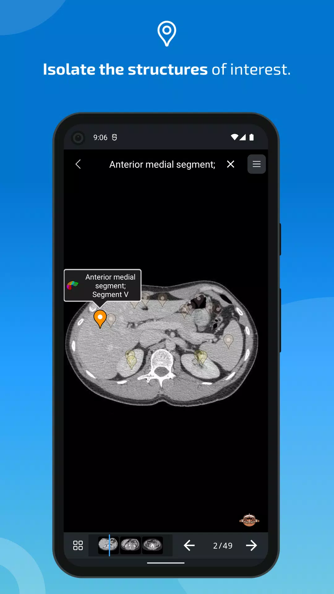 e-Anatomy ဖန်သားပြင်ဓာတ်ပုံ 4